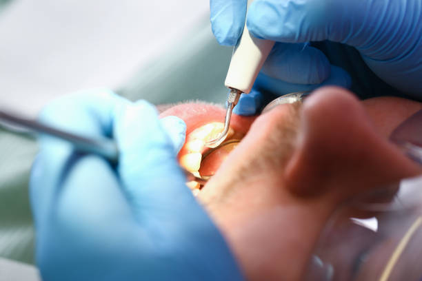 Best Emergency Dental Extractions in North Industry, OH