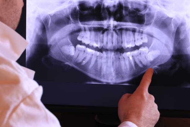 Best Broken or Cracked Tooth Emergency Dentist in North Industry, OH