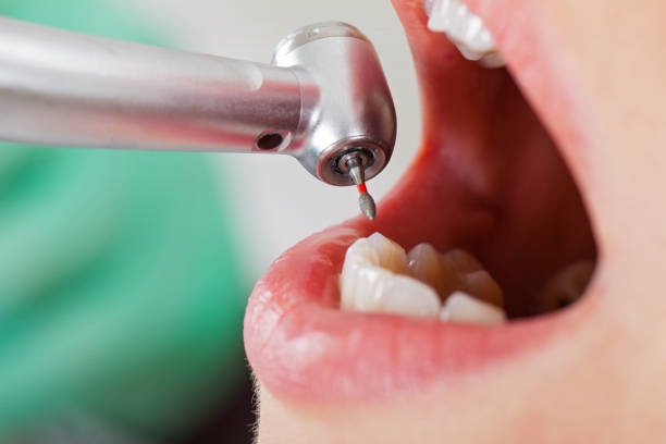 Best Holiday Emergency Dentist in North Industry, OH